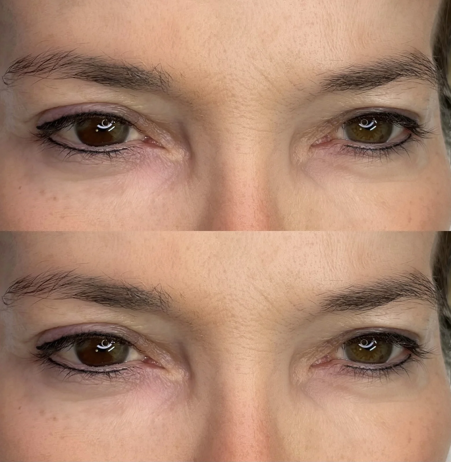Eyeliner tattoo result — NeoTempo Aesthetics