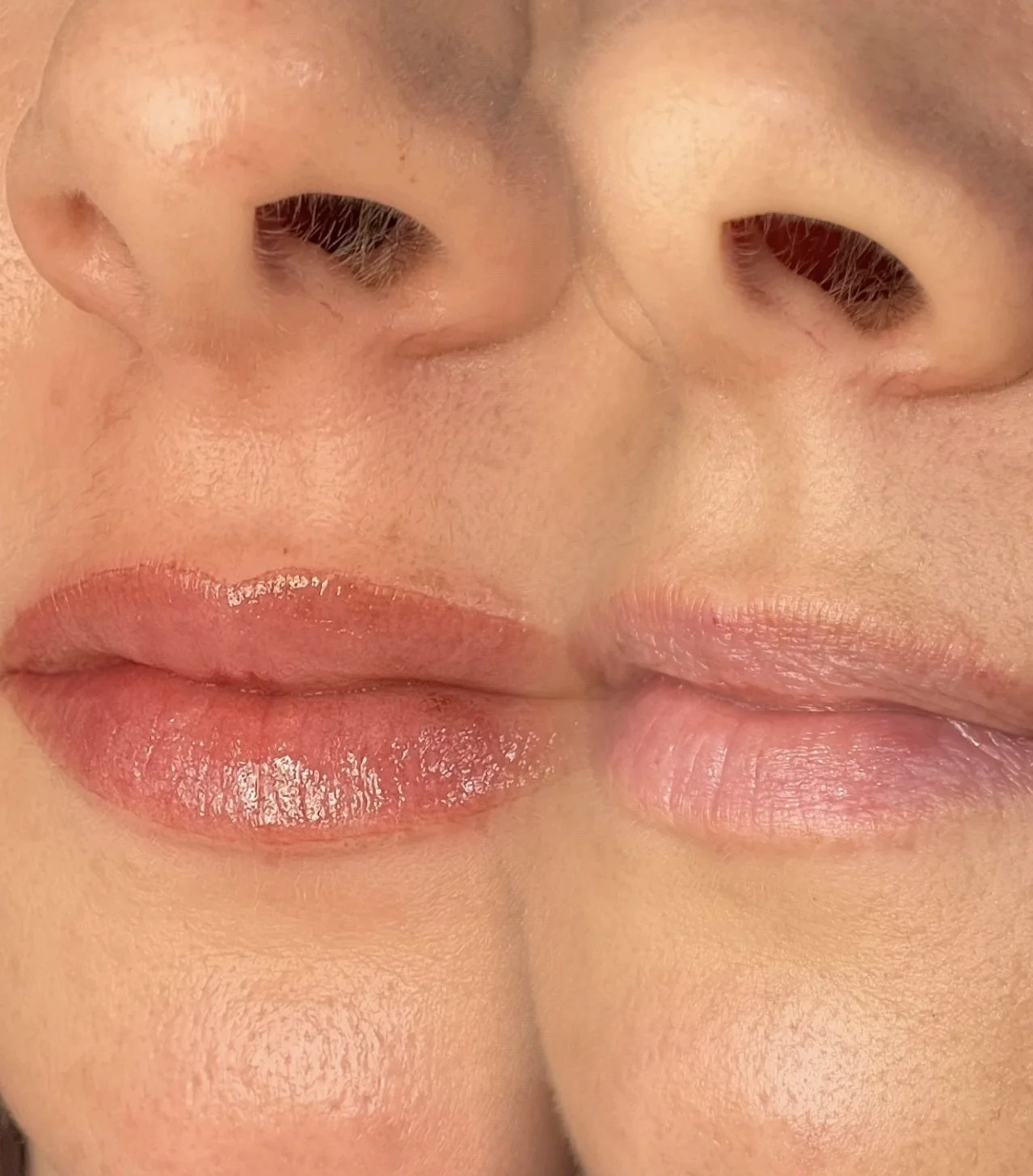 Lip tattoo result — NeoTempo Aesthetics