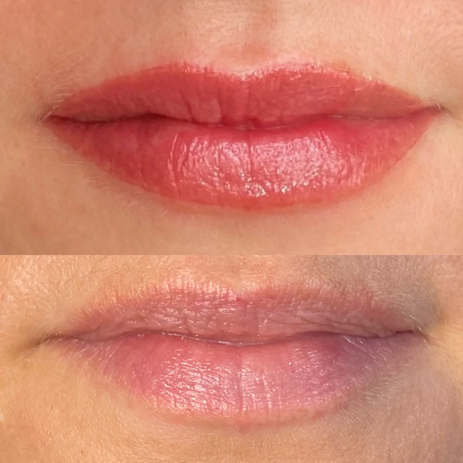 Lip tattoo result — NeoTempo Aesthetics