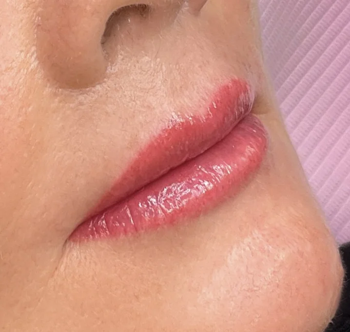 Lip tattoo result — NeoTempo Aesthetics