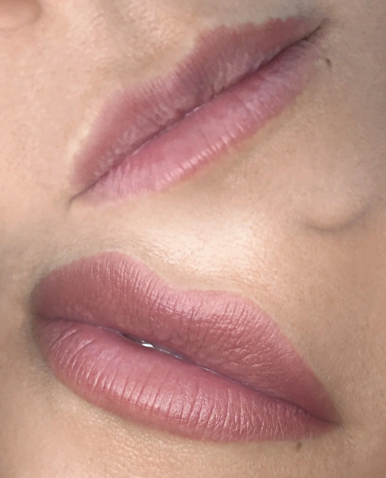 Lip tattoo result — NeoTempo Aesthetics