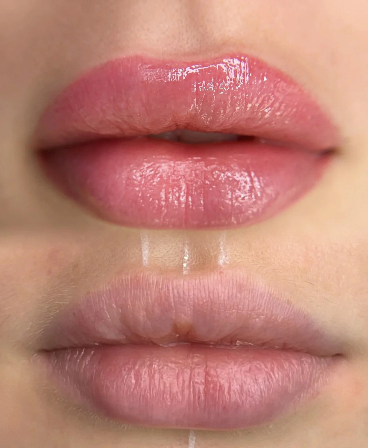 Lip tattoo result — NeoTempo Aesthetics