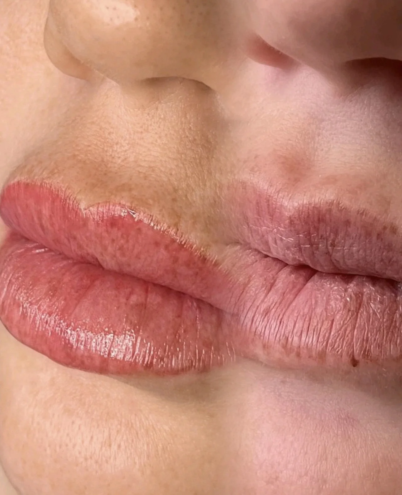 Lip tattoo result — NeoTempo Aesthetics