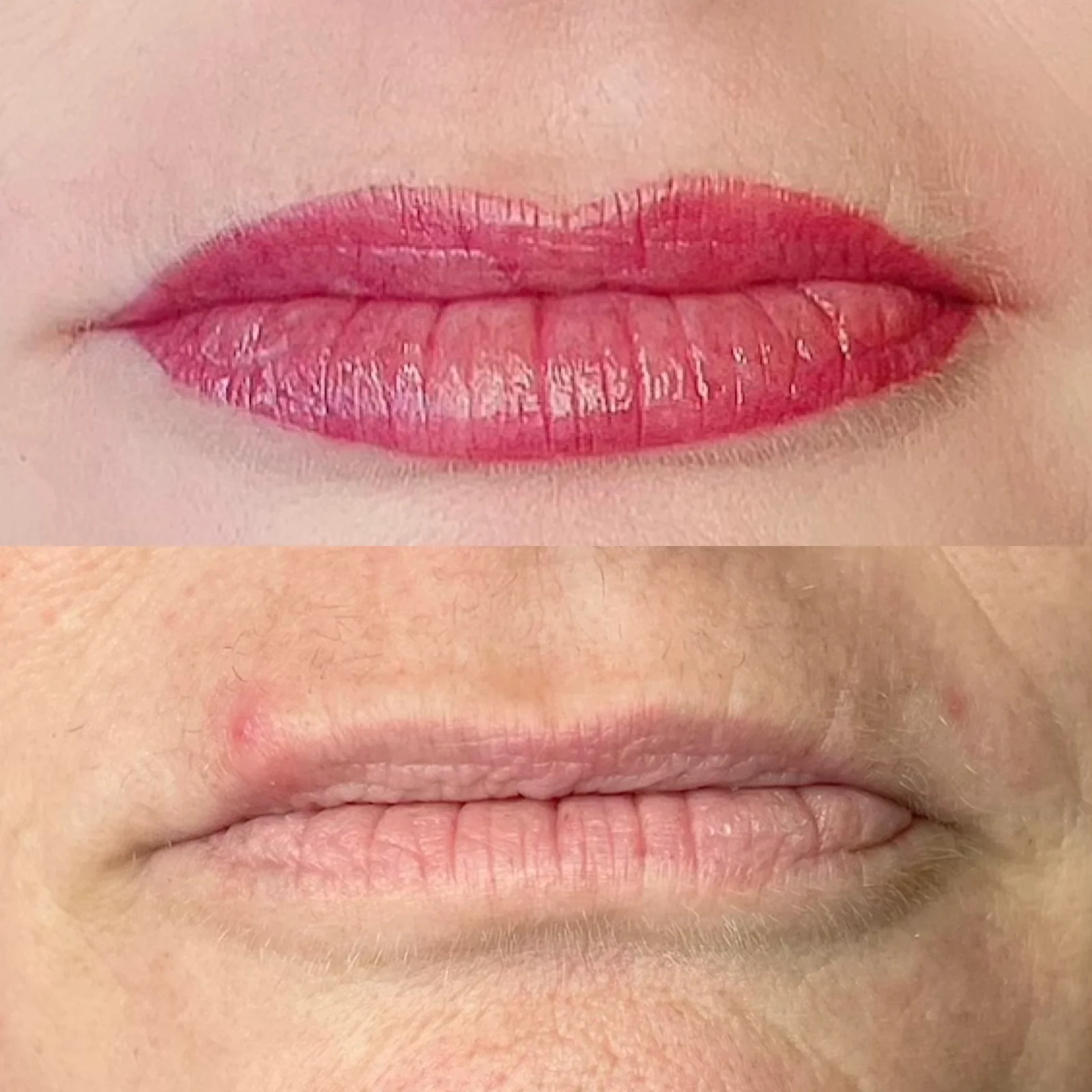 Lip tattoo result — NeoTempo Aesthetics