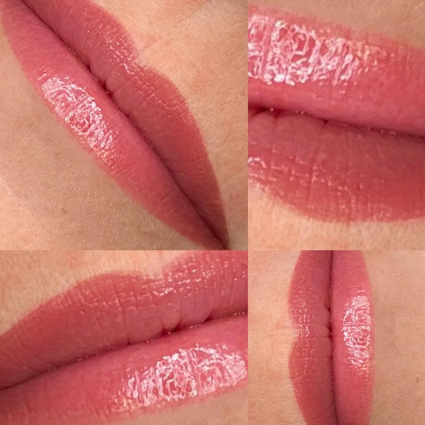 Lips